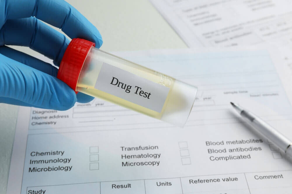 Drug test. Laboratory worker holding container with urine sample over medical form on table